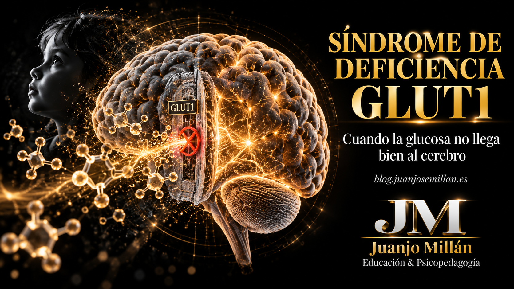 Síndrome de Deficiencia GLUT 1